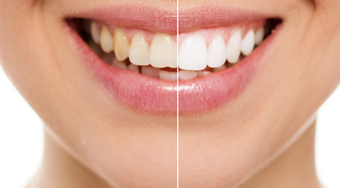 Dentiste Soissons